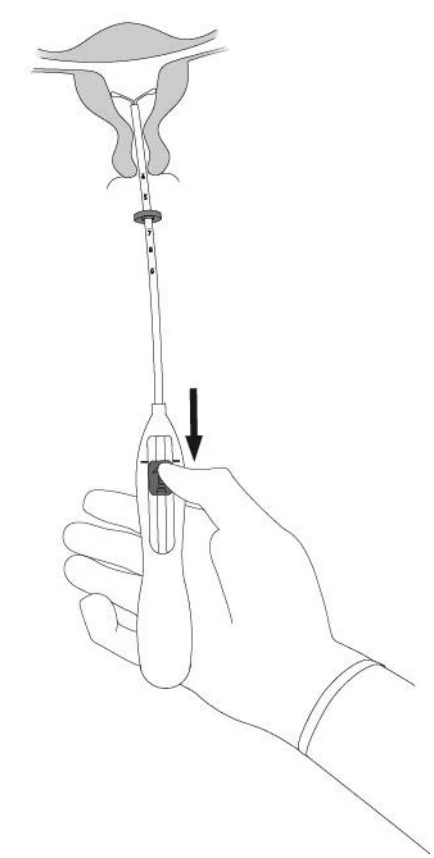 Figure_5b.jpg